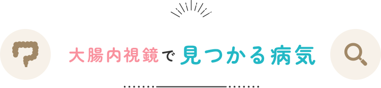 大腸カメラ(大腸内視鏡検査)で見つかる病気