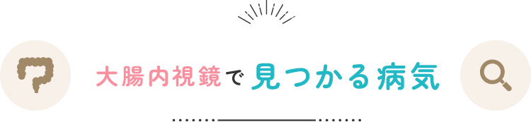 大腸カメラ(大腸内視鏡検査)で見つかる病気